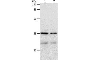 Western Blotting (WB) image for anti-Cyclin-Dependent Kinase 4 (CDK4) antibody (ABIN2427935)