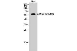 Western Blotting (WB) image for anti-6-phosphofructo-2-Kinase/fructose-2,6-Biphosphatase 2 (PFKFB2) (pSer483) antibody (ABIN3173263) (PFKFB2 anticorps  (pSer483))