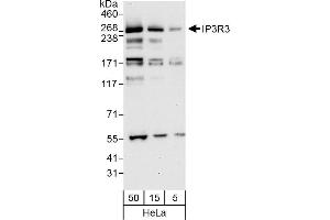Western Blotting (WB) image for anti-Inositol 1,4,5-Trisphosphate Receptor, Type 3 (ITPR3) (AA 1755-1825) antibody (ABIN7451818)