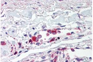 Human Lung, Alveolar Macrophages (formalin-fixed, paraffin-embedded) stained with TLR5 antibody ABIN214528 at 5 ug/ml followed by biotinylated goat anti-rabbit IgG secondary antibody ABIN481713, alkaline phosphatase-streptavidin and chromogen. (TLR5 anticorps  (Internal Region))