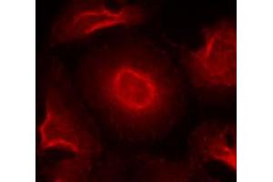 Immunofluorescence staining of methanol-fixed HeLa cells using GRIN2B polyclonal antibody (Cat # PAB12211, Red). (GRIN2B anticorps  (Tyr1474))