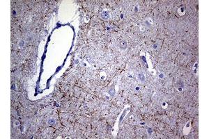 Image no. 4 for anti-Neurofilament, Light Polypeptide (NEFL) (AA 1-360) antibody (ABIN1490762) (NEFL anticorps  (AA 1-360))