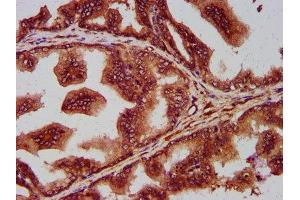 IHC image of ABIN7168647 diluted at 1:400 and staining in paraffin-embedded human prostate tissue performed on a Leica BondTM system. (SEC14L2 anticorps  (AA 233-358))