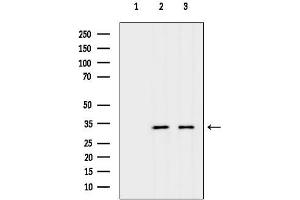 anti-Solute Carrier Family 25, Member 42 (SLC25A42) antibody