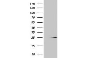 Western Blotting (WB) image for anti-MOB Kinase Activator 1B (MOB1B) antibody (ABIN1499532) (MOBKL1A anticorps)
