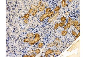 ABIN7095942 and ABIN7100004 at 1/100 staining rat kidney tissue by IHC-P.