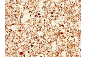 IHC image of ABIN7146715 diluted at 1:400 and staining in paraffin-embedded human brain tissue performed on a Leica BondTM system. (CA2 anticorps  (AA 2-260))