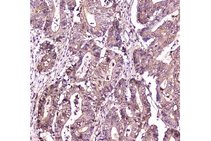 IHC analysis of S100A10 using anti-S100A10 antibody .