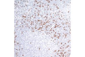 Immunohistochemistry (IHC) image for anti-CD8a Molecule (CD8A) (AA 185-235) antibody (ABIN7449561)