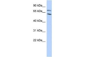Western Blotting (WB) image for anti-Metastasis Associated 1 Family, Member 2 (MTA2) antibody (ABIN2458168) (MTA2 anticorps)