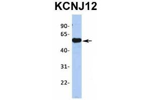 Host:  Rabbit  Target Name:  KCNJ12  Sample Type:  Human Fetal Brain  Antibody Dilution:  1. (Kir2.2 anticorps  (Middle Region))