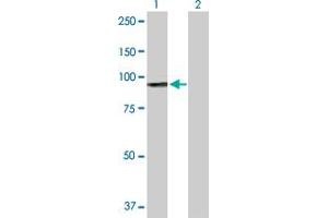 Western Blot analysis of H6PD expression in transfected 293T cell line by H6PD MaxPab polyclonal antibody. (Glucose-6-Phosphate Dehydrogenase anticorps  (AA 1-791))