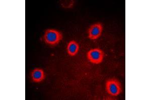 Immunofluorescent analysis of Cytokeratin 8 staining in DLD cells. (KRT8 anticorps  (Center))
