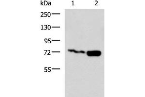 Western blot analysis of Jurkat and Raji cell lysates using PUM3 Polyclonal Antibody at dilution of 1:800 (Pumilio 3 anticorps)