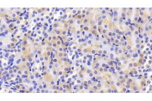 Detection of ACO1 in Mouse Kidney Tissue using Polyclonal Antibody to Aconitase 1 (ACO1)