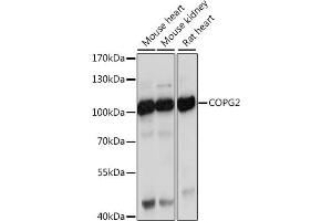 Western blot analysis of extracts of various cell lines, using COPG2 antibody (ABIN7266426) at 1:1000 dilution. (COPG2 anticorps  (AA 542-871))