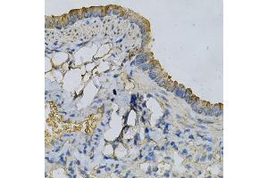 Immunohistochemistry of paraffin-embedded mouse lung using APRT Antibody (ABIN6291536) at dilution of 1:100 (40x lens).