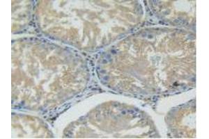 Detection of AST in Rat Testis Tissue using Polyclonal Antibody to Aspartate Aminotransferase (AST)