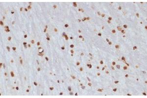 Immunohistochemistry of paraffin-embedded Mouse brain using Phospho-CHEK1(S280) Polyclonal Antibody at dilution of 1:100 (40x lens). (CHEK1 anticorps  (pSer280))
