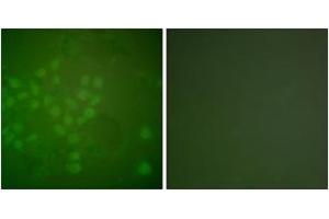 Immunofluorescence analysis of A549 cells, using RAD17 (Ab-645) Antibody. (RAD17 anticorps  (AA 621-670))