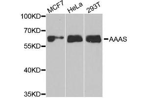 Western blot analysis of extracts of various cell lines, using AAAS antibody. (Adracalin anticorps  (AA 287-546))