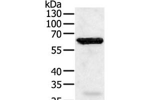 Western Blot analysis of Jurkat cell using TRAF5 Polyclonal Antibody at dilution of 1:450 (TRAF5 anticorps)