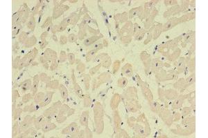 Immunohistochemistry of paraffin-embedded human heart tissue using ABIN7161056 at dilution of 1:100