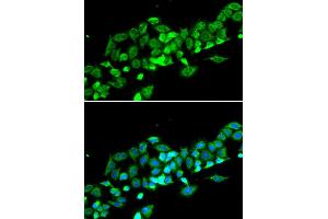 Immunofluorescence analysis of MCF-7 cell using RASSF1 antibody. (RASSF1 anticorps)