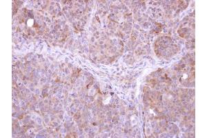IHC-P Image Immunohistochemical analysis of paraffin-embedded SW480 xenograft, using FBXL12, antibody at 1:500 dilution.