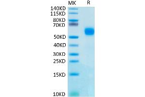 Human IL1R2 on Tris-Bis PAGE under reduced condition. (IL1R2 Protein (His tag))