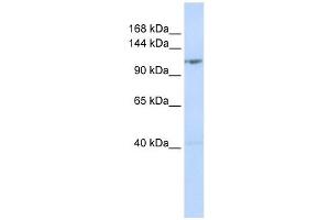 DDX46 antibody used at 1 ug/ml to detect target protein. (DDX46 anticorps)