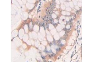 IHC-P analysis of Human Tissue, with DAB staining. (BMP2 anticorps  (AA 283-396))