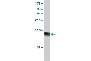 Western Blot detection against Immunogen (36. (NCAPG anticorps  (AA 336-435))