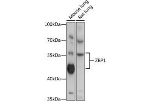 Western blot analysis of extracts of various cell line, using ZBP1 antibody (ABIN6128935, ABIN6150365, ABIN6150367 and ABIN6218066) at 1:3000 dilution.