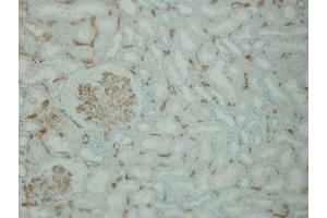 Immunohistochemistry (IHC) image for anti-Complement Component C4d (C4d) antibody (ABIN870587) (Complement C4d anticorps)