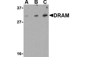 Western blot analysis of DRAM in K562 cell lysate with DRAM antibody at (A) 0. (DRAM anticorps  (N-Term))
