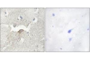 Immunohistochemistry analysis of paraffin-embedded human brain tissue, using LMTK2 Antibody. (LMTK2 anticorps  (AA 651-700))