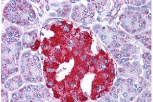 Human Pancreas: Formalin-Fixed, Paraffin-Embedded (FFPE)