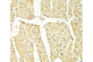 Immunohistochemistry of paraffin-embedded Mouse heart using PSMC2 Polyclonal Antibody at dilution of 1:100 (40x lens).