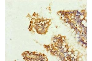 Immunohistochemistry of paraffin-embedded human small intestine tissue using ABIN7149102 at dilution of 1:100