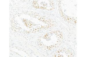 Immunohistochemistry (IHC) image for anti-Bromodomain Containing 7 (BRD7) (AA 601-651) antibody (ABIN7453996) (Recombinant BRD7 anticorps  (AA 601-651))