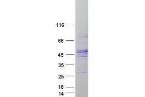 Validation with Western Blot