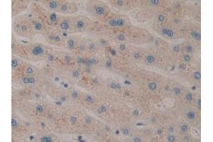 Detection of CIDEC in Human Liver Tissue using Polyclonal Antibody to Cell Death Inducing DFFA Like Effector C (CIDEC)