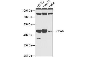Western blot analysis of extracts of various cell lines, using CP antibody (ABIN6129673, ABIN6138930, ABIN6138932 and ABIN6217722) at 1:1000 dilution. (CPA6 anticorps  (AA 130-437))