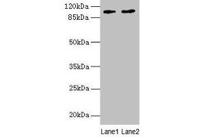 Western blot All lanes: CCDC57 antibody at 1.