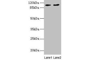Western blot All lanes: CCDC57 antibody at 1. (CCDC57 anticorps  (AA 1-300))