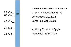 WB Suggested Anti-ARHGEF19  Antibody Titration: 0. (ARHGEF19 anticorps  (Middle Region))