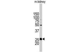 Western blot analysis of STC2 polyclonal antibody  in mouse kidney tissue lysates (35 ug/lane). (Stanniocalcin 2 anticorps  (N-Term))