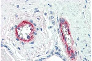 Human Placenta, Vessels (formalin-fixed, paraffin-embedded) stained with F8 antibody ABIN396921 at 10 ug/ml followed by biotinylated anti-mouse IgG secondary antibody ABIN481714, alkaline phosphatase-streptavidin and chromogen. (Factor VIII anticorps)