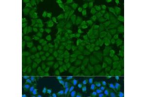 Immunofluorescence analysis of U2OS cells using IL27RA Polyclonal Antibody at dilution of 1:100. (IL27 Receptor alpha anticorps)